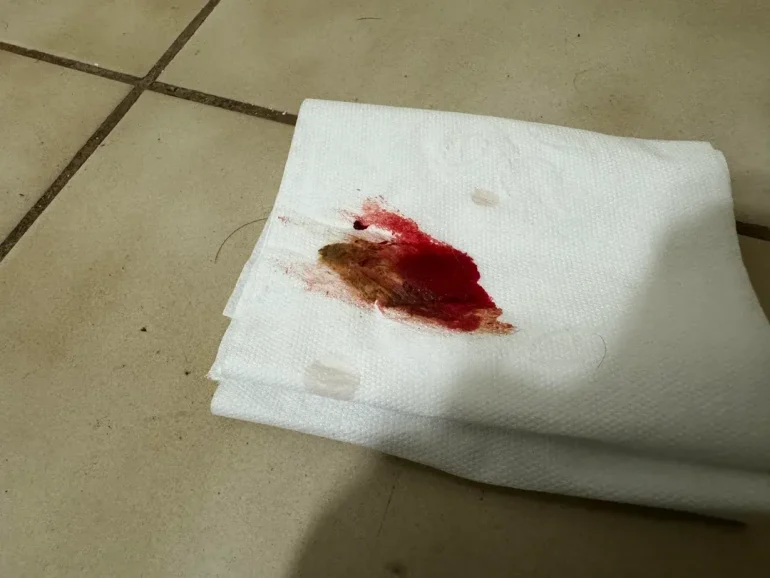 Krv na toalet papiru