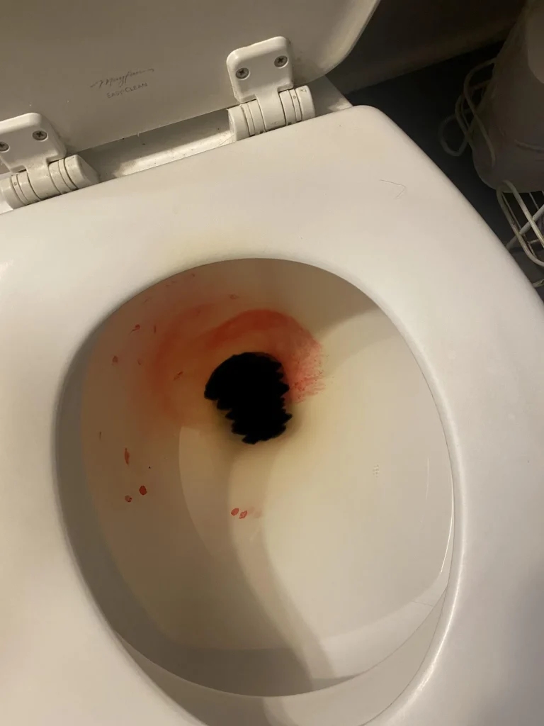 Krv u toaletu