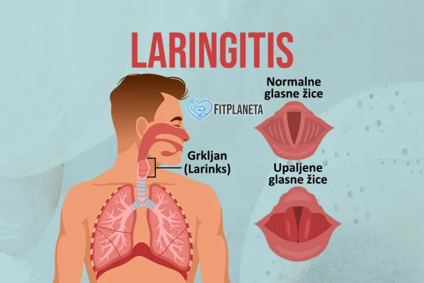 Laringitis kod dece odraslih beba