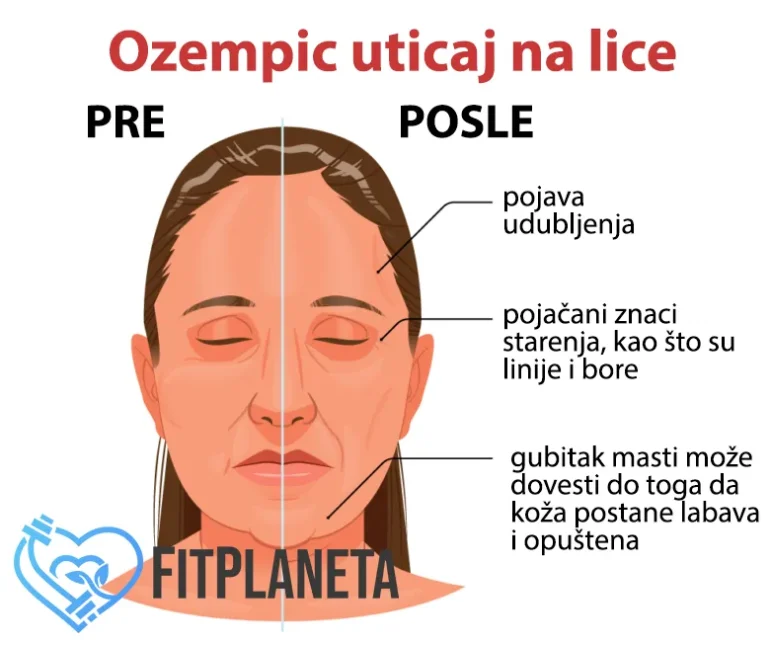 Ozempic uticaj na lice