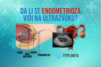 Da li se Endometrioza vidi na ultrazvuku