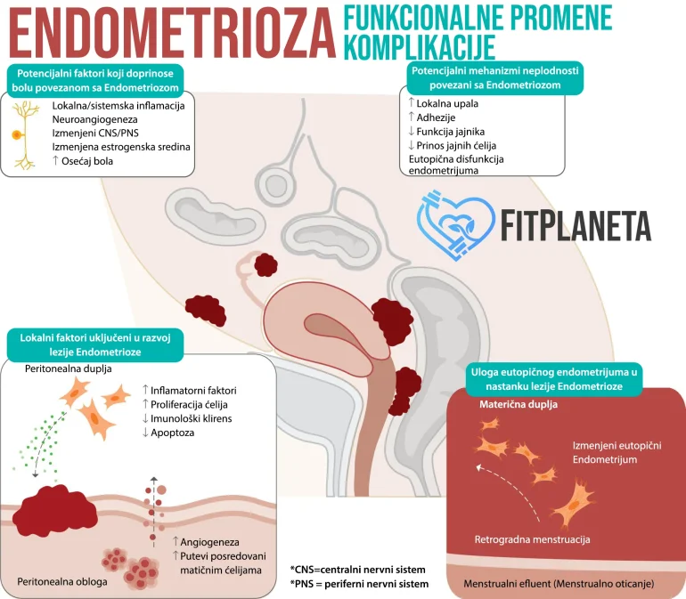 Endometrioza Komplikacije i funkcionalne promene patofiziologija