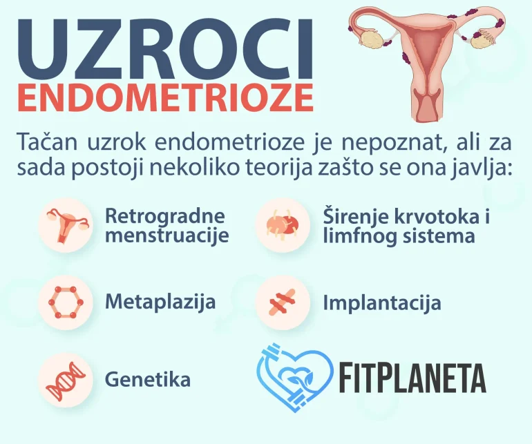 Endometrioza Uzroci