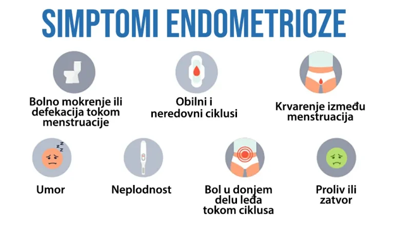 Simptomi endometrioze