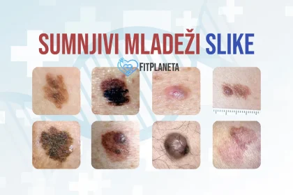 Sumnjivi mladeži slike