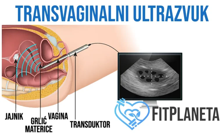 Transvaginalni ultrazvuk