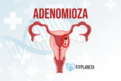 Adenomioza