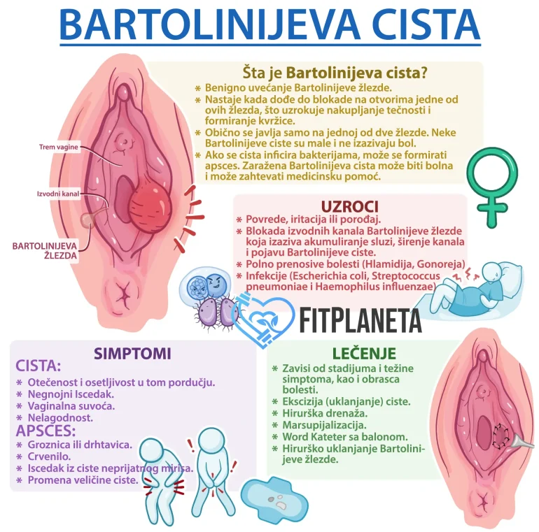 Bartolinijeva žlezda cista