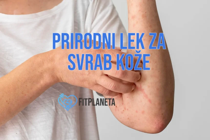 Prirodni lek za svrab kože