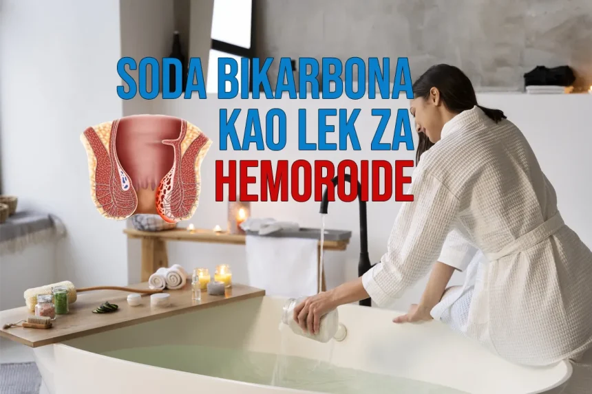 Soda bikarbona kao lek za hemoroide