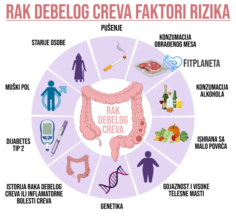 Tumor debelog creva Faktori rizika