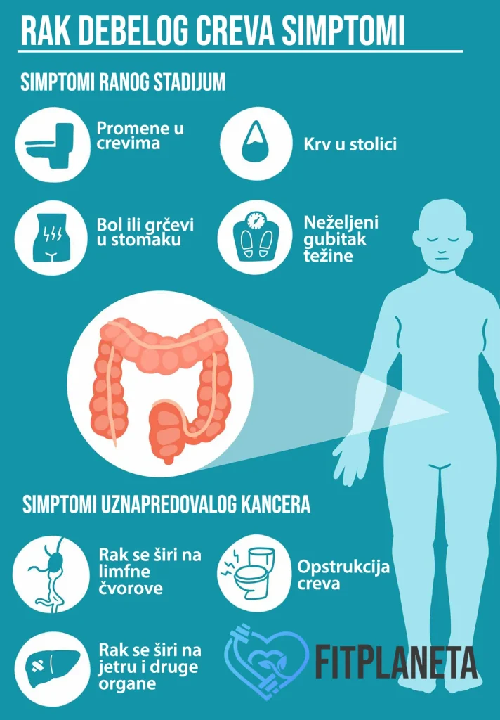 Tumor debelog creva Simptomi